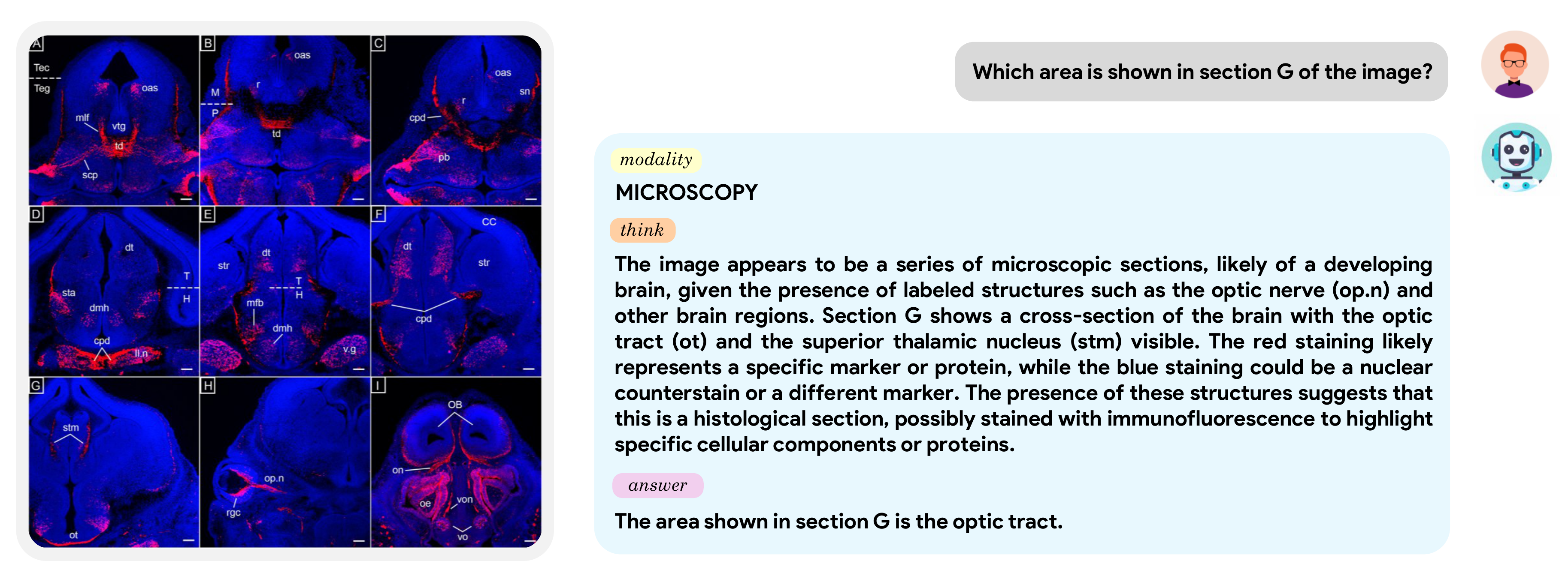 Microscopy example — MediX-R1 identifies the optic tract